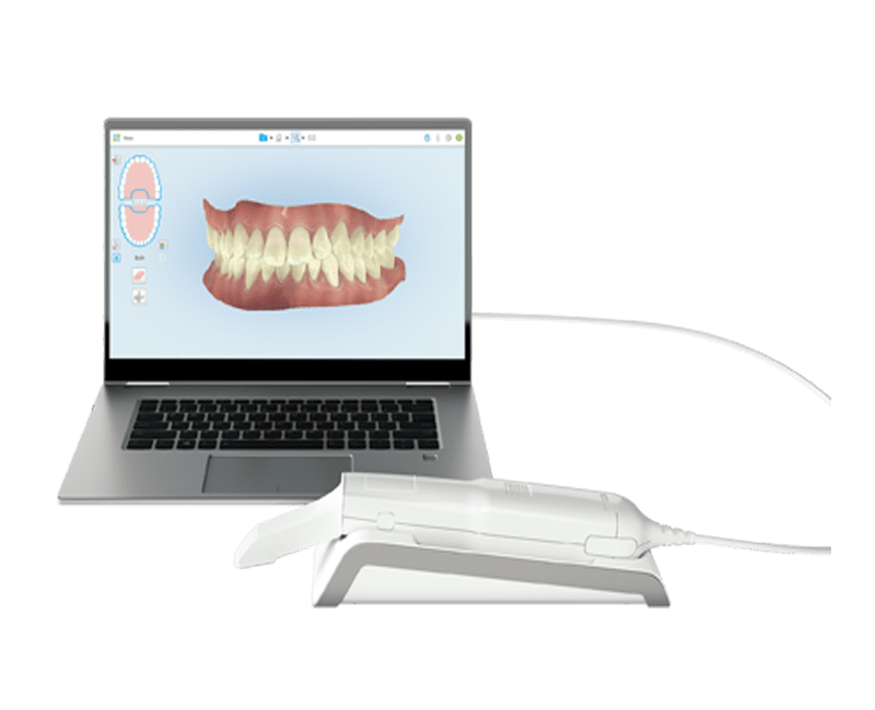dentists 3D Scanners - ITero